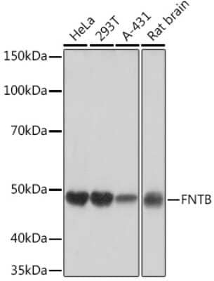 Western Blot: FNTB Antibody (3I4X5) [NBP3-15557]