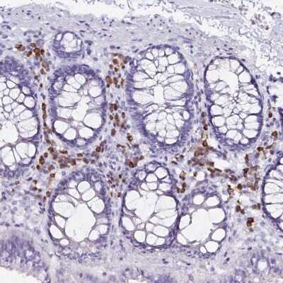Immunohistochemistry-Paraffin: FNTB Antibody [NBP2-38002]