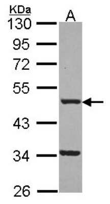 Western Blot: FNTB Antibody [NBP2-14960]