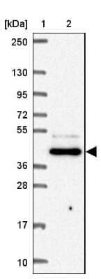 Western Blot: FNTB Antibody [NBP2-38002]