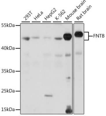 Western Blot: FNTB AntibodyAzide and BSA Free [NBP3-04420]