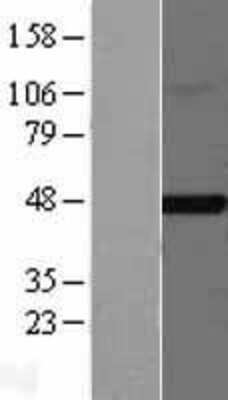 Western Blot: FNTB Overexpression Lysate [NBL1-10788]