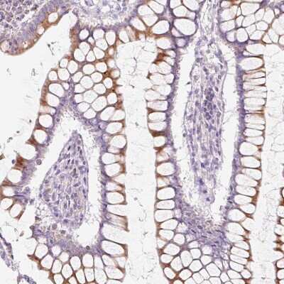 Immunohistochemistry-Paraffin: FOCAD Antibody [NBP2-49163]