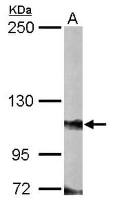 Western Blot: FOG2 Antibody [NBP1-32895]