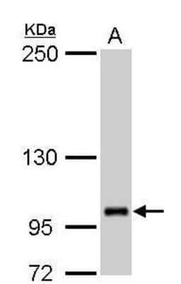 Western Blot: FOG2 Antibody [NBP1-32895]