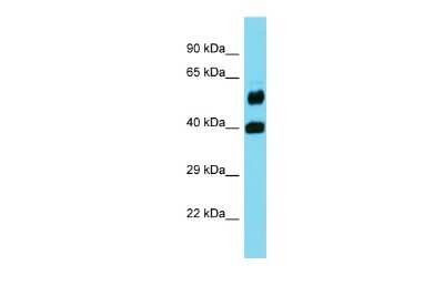 Western Blot: FOLH1B Antibody [NBP3-09721]