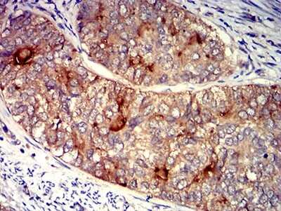 Immunohistochemistry-Paraffin: FOLR1 Antibody (2G5C12) - BSA Free [NBP2-61773]