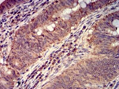Immunohistochemistry-Paraffin: FOLR1 Antibody (2G5C12) - BSA Free [NBP2-61773]