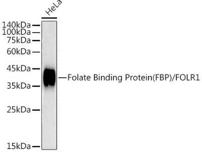 Western Blot: FOLR1 Antibody (3J6W3) [NBP3-16069]