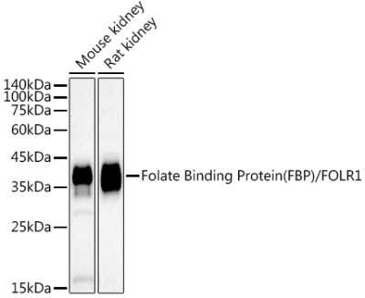 Western Blot: FOLR1 Antibody (3J6W3) [NBP3-16069]