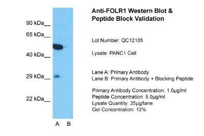 Western Blot: FOLR1 Antibody [NBP1-69363]