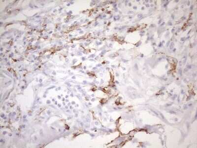 Immunohistochemistry: FOLR2 Antibody (OTI4G6) [NBP2-45693]