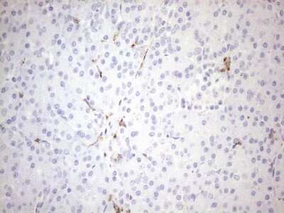 Immunohistochemistry: FOLR2 Antibody (OTI4G6) [NBP2-45693]