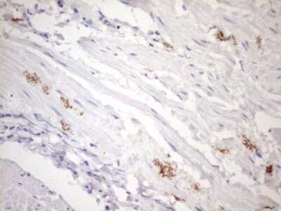 Immunohistochemistry: FOLR2 Antibody (OTI4G6) [NBP2-45693]
