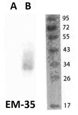 Western Blot: FOLR2 Antibody (EM-35) [NBP2-62208]