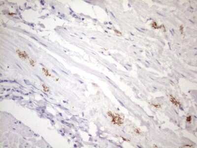 Immunohistochemistry: FOLR2 Antibody (OTI4G6) - Azide and BSA Free [NBP2-70763]