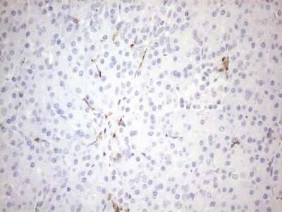 Immunohistochemistry: FOLR2 Antibody (OTI4G6) - Azide and BSA Free [NBP2-70763]