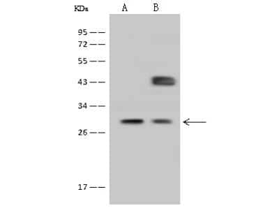 Western Blot: FOLR2 Antibody [NBP2-99741]