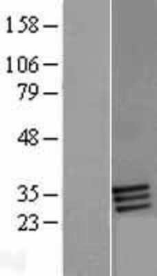 Western Blot: FOLR2 Overexpression Lysate [NBP2-09387]