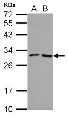 Western Blot: FOLR4 Antibody [NBP2-16514]