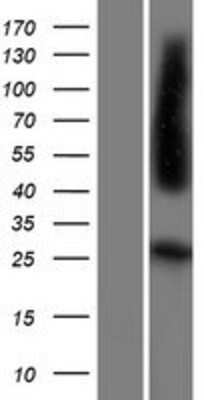 Western Blot: FOLR4 Overexpression Lysate [NBP2-08395]