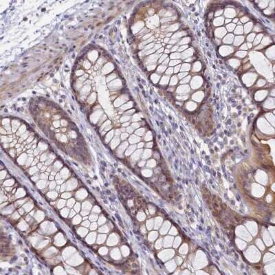 Immunohistochemistry-Paraffin: FOPNL Antibody [NBP1-84109]