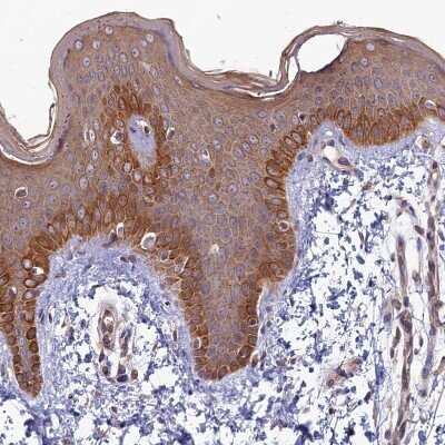 Immunohistochemistry-Paraffin: FOPNL Antibody [NBP1-84109]