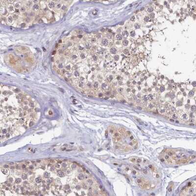 Immunohistochemistry-Paraffin: FOPNL Antibody [NBP1-84109]