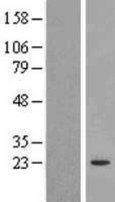 Western Blot: FOPNL Overexpression Lysate [NBL1-08223]