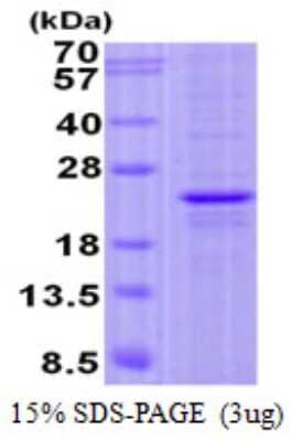 SDS-PAGE: Recombinant Human FOPNL His Protein [NBP2-23047]