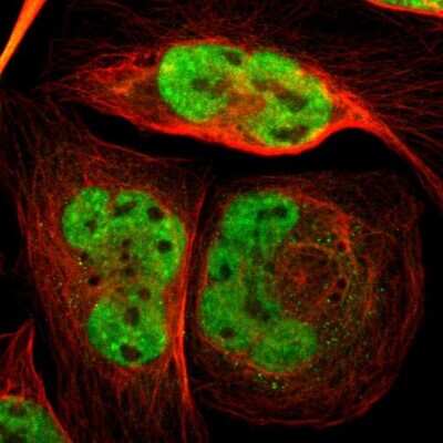 FOX2 Antibody (NBP1-91910)