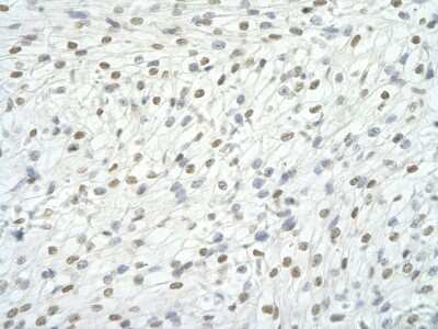 Immunohistochemistry-Paraffin: FOX2 Antibody [NBP1-57373]