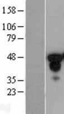 Western Blot: HNF-3 alpha/FoxA1 Overexpression Lysate [NBL1-10798]