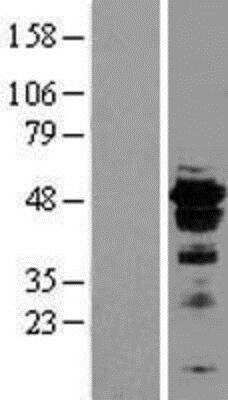 Western Blot: HNF-3 beta/FoxA2 Overexpression Lysate [NBL1-10799]