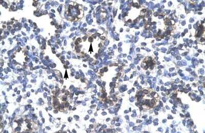 Immunohistochemistry: FOXA3 Antibody [NBP2-87461]