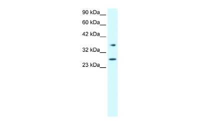 Western Blot: FOXA3 Antibody [NBP2-87461]