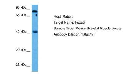 Western Blot: FOXA3 Antibody [NBP2-87461]