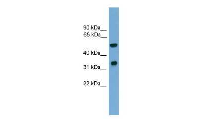 Western Blot: FOXA3 Antibody [NBP2-87462]