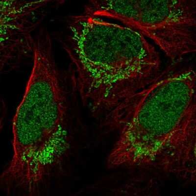 Immunocytochemistry/ Immunofluorescence: FOXB1 Antibody [NBP2-57899]