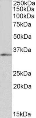 Western Blot: FOXB1 Antibody [NB100-1267]