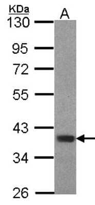 Western Blot: FOXB1 Antibody [NBP2-16517]