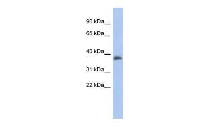 Western Blot: FOXB1 Antibody [NBP2-87463]