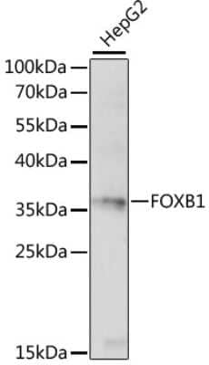 Western Blot: FOXB1 AntibodyAzide and BSA Free [NBP3-03931]