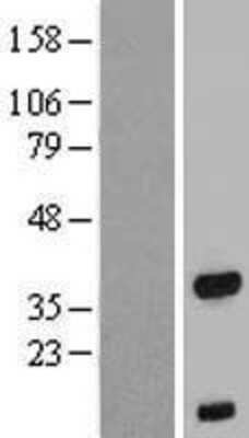 Western Blot: FOXB1 Overexpression Lysate [NBP2-07480]