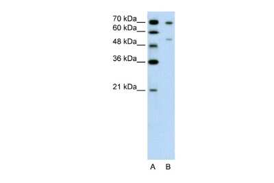 Western Blot: FOXB2 Antibody [NBP2-82825]