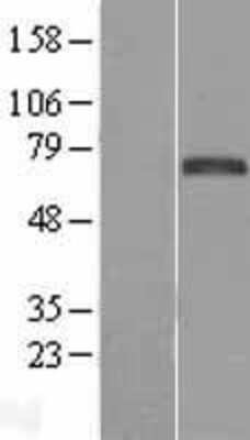 Western Blot: FoxC1 Overexpression Lysate [NBL1-10801]