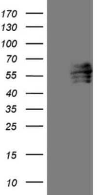 Western Blot: FoxC2 Antibody (OTI3E3) [NBP2-45710]