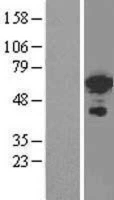 Western Blot: FoxC2 Overexpression Lysate [NBL1-10802]