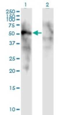 Western Blot: FOXD1 Antibody (2C10) [H00002297-M01]