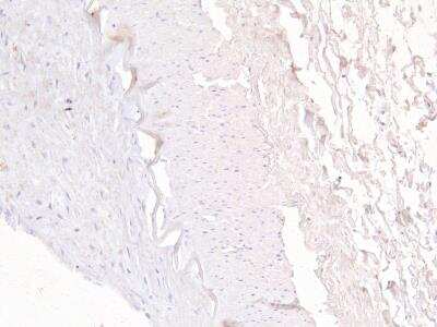 Immunohistochemistry-Paraffin: FOXD1 Antibody [NB300-925]